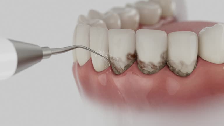 Reliable Emergency Dentist contractor in Ash Flat, AR by Smile Center Dentistry